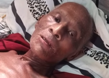 Sem conseguir internação, morador de Campos apela: “não me deixem morrer assim não”