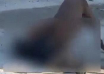 Tristeza: idoso atacado por Pitbulls não resiste e morre no Ferreira Machado