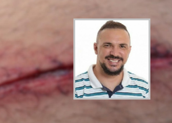 Polícia conclui que vereador de Campos mentiu ao dizer que foi esfaqueado na Usina do Queimado