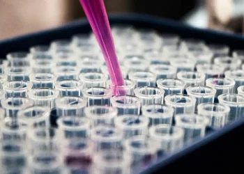 pesquisas-brasileiras-avancam-no-diagnostico-de-alzheimer