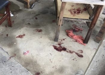Bebê atacado por pitbull em Campos passa por cirurgia e está internado em estado gravíssimo