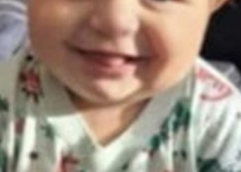 Bebê atacado por pitbull em Campos não resiste e morre