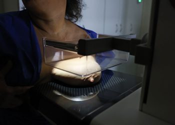 vigitel:-92%-das-brasileiras-entre-50-e-69-anos-fizeram-mamografia