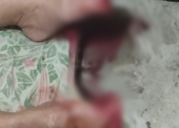 Filha é presa após decepar os dedos da própria mãe em Itaperuna