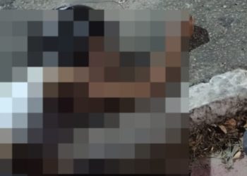 Acidente deixa motociclista gravemente ferida em Campos