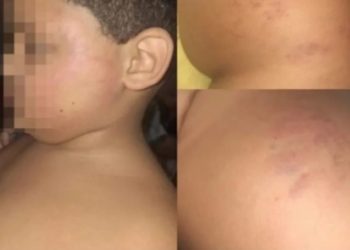 Família denuncia supostas agressões a criança autista em escola particular de Campos