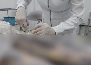 Órgão genital de cadáver é removido e colocado em outro na Faculdade de Medicina de Campos