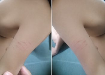Criança de 5 anos é supostamente agredida dentro de escola de Campos