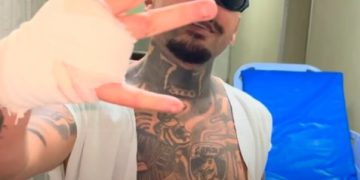 Influencer tem dedo amputado ao tentar pular muro do Rock in Rio
